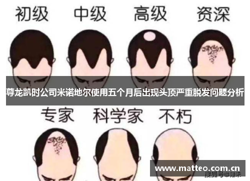 尊龙凯时公司米诺地尔使用五个月后出现头顶严重脱发问题分析